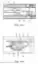Fig. 17 - Biopsy device arming mechanism