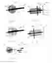 Fig. 08 - METHOD AND DEVICE FOR EXTRACTING MULTIPLE TISSUE SAMPLES