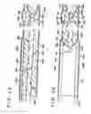 Fig. 05 - VEIN DISSECTING DEVICE AND METHOD