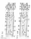 Fig. 06 - VEIN DISSECTING DEVICE AND METHOD