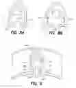 Fig. 09 - VEIN DISSECTING DEVICE AND METHOD