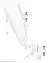 Fig. 24 - VEIN DISSECTING DEVICE AND METHOD