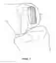 Fig. 03 - Arthoplasty systems and methods for optimally aligning and tensioning a knee prosthesis
