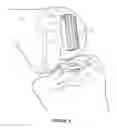 Fig. 05 - Arthoplasty systems and methods for optimally aligning and tensioning a knee prosthesis