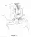 Fig. 06 - Arthoplasty systems and methods for optimally aligning and tensioning a knee prosthesis