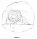 Fig. 22 - Arthoplasty systems and methods for optimally aligning and tensioning a knee prosthesis