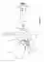 Fig. 23 - Arthoplasty systems and methods for optimally aligning and tensioning a knee prosthesis