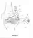 Fig. 28 - Arthoplasty systems and methods for optimally aligning and tensioning a knee prosthesis