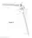 Fig. 32 - Arthoplasty systems and methods for optimally aligning and tensioning a knee prosthesis