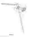 Fig. 37 - Arthoplasty systems and methods for optimally aligning and tensioning a knee prosthesis