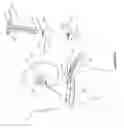Fig. 42 - Arthoplasty systems and methods for optimally aligning and tensioning a knee prosthesis