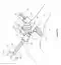 Fig. 45 - Arthoplasty systems and methods for optimally aligning and tensioning a knee prosthesis