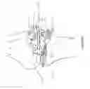 Fig. 48 - Arthoplasty systems and methods for optimally aligning and tensioning a knee prosthesis
