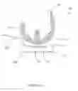 Fig. 51 - Arthoplasty systems and methods for optimally aligning and tensioning a knee prosthesis