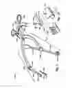 Fig. 02 - SELF-RETAINING RETRACTOR FOR HIP REPLACEMENT SURGERY