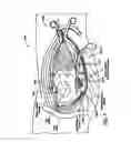 Fig. 06 - SELF-RETAINING RETRACTOR FOR HIP REPLACEMENT SURGERY