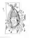 Fig. 07 - SELF-RETAINING RETRACTOR FOR HIP REPLACEMENT SURGERY