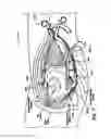Fig. 08 - SELF-RETAINING RETRACTOR FOR HIP REPLACEMENT SURGERY