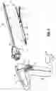 Fig. 02 - Surgical apparatus