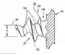 Fig. 01 - Surgical fastener applying apparatus, kits and methods for endoscopic procedures