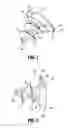 Fig. 02 - Surgical fastener applying apparatus, kits and methods for endoscopic procedures