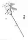 Fig. 04 - Surgical fastener applying apparatus, kits and methods for endoscopic procedures