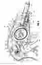 Fig. 07 - Surgical fastener applying apparatus, kits and methods for endoscopic procedures