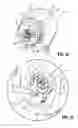 Fig. 10 - Surgical fastener applying apparatus, kits and methods for endoscopic procedures
