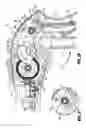 Fig. 16 - Surgical fastener applying apparatus, kits and methods for endoscopic procedures