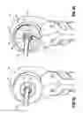 Fig. 22 - Surgical fastener applying apparatus, kits and methods for endoscopic procedures