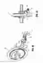 Fig. 25 - Surgical fastener applying apparatus, kits and methods for endoscopic procedures
