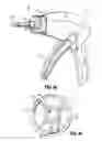 Fig. 26 - Surgical fastener applying apparatus, kits and methods for endoscopic procedures