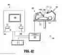 Fig. 26 - Endoscopic reposable surgical clip applier