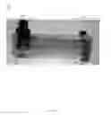 Fig. 05 - SUTURELESS ANASTOMOSIS DEVICE