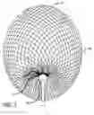 Fig. 03 - DEVICES FOR THERAPEUTIC VASCULAR PROCEDURES