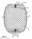 Fig. 06 - DEVICES FOR THERAPEUTIC VASCULAR PROCEDURES