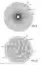 Fig. 08 - DEVICES FOR THERAPEUTIC VASCULAR PROCEDURES
