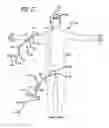 Fig. 13 - DEVICES FOR THERAPEUTIC VASCULAR PROCEDURES