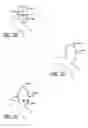 Fig. 15 - DEVICES FOR THERAPEUTIC VASCULAR PROCEDURES