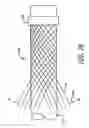 Fig. 18 - DEVICES FOR THERAPEUTIC VASCULAR PROCEDURES