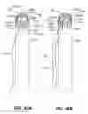 Fig. 29 - DEVICES FOR THERAPEUTIC VASCULAR PROCEDURES