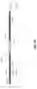 Fig. 43 - DEVICES FOR THERAPEUTIC VASCULAR PROCEDURES
