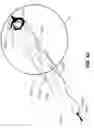 Fig. 46 - DEVICES FOR THERAPEUTIC VASCULAR PROCEDURES