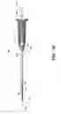 Fig. 02 - Stabilizing microfracture device