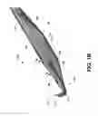 Fig. 03 - Stabilizing microfracture device