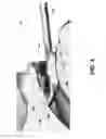 Fig. 08 - Stabilizing microfracture device