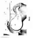 Fig. 13 - Stabilizing microfracture device