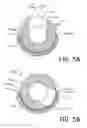 Fig. 06 - Arthroscopic devices and methods