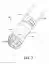 Fig. 08 - Arthroscopic devices and methods