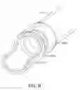Fig. 09 - Arthroscopic devices and methods